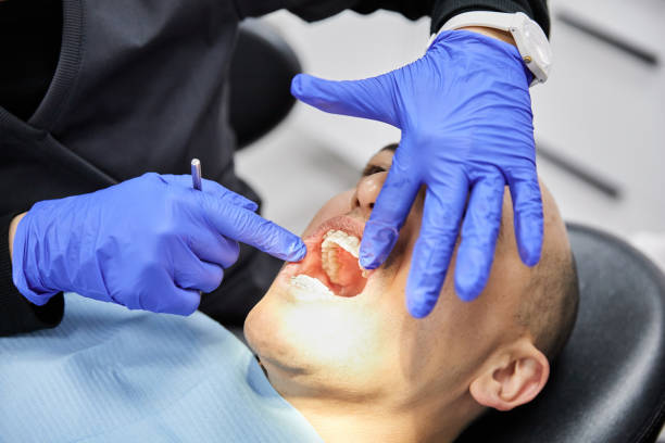 Best Emergency Gum Treatment in San Mateo, CA