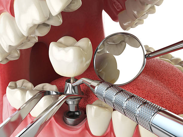 Best Cosmetic Emergency Dentistry in San Mateo, CA